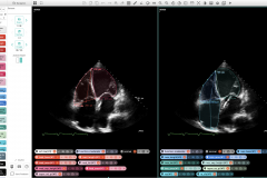 AI Diagnostic Support System